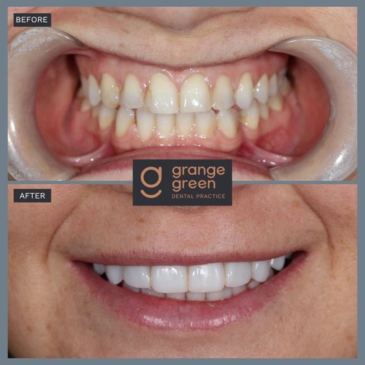 Smile Gallery at Grange Green Dental Practice in Billericay