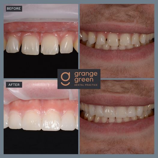 Smile Gallery at Grange Green Dental Practice in Billericay